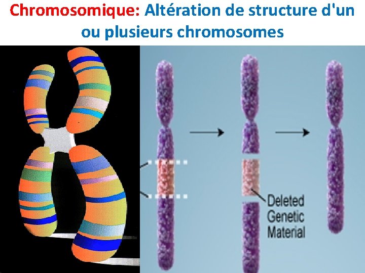 Chromosomique: Altération de structure d'un ou plusieurs chromosomes Chromosomique: Altération de structure d'un ou plusieurs chromosomes