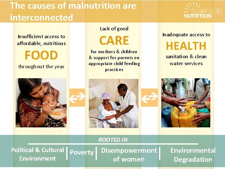 The causes of malnutrition are interconnected Lack of good Insufficient access to affordable, nutritious The causes of malnutrition are interconnected Lack of good Insufficient access to affordable, nutritious