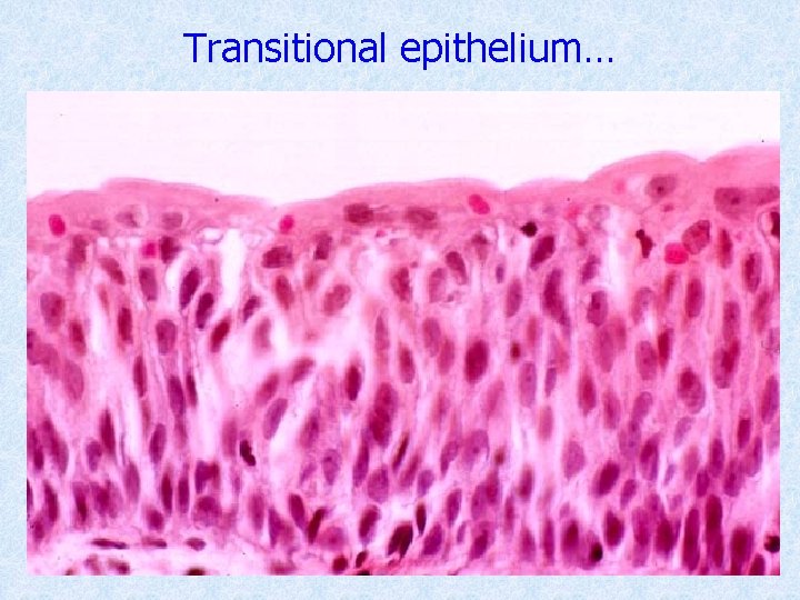 Transitional epithelium… 