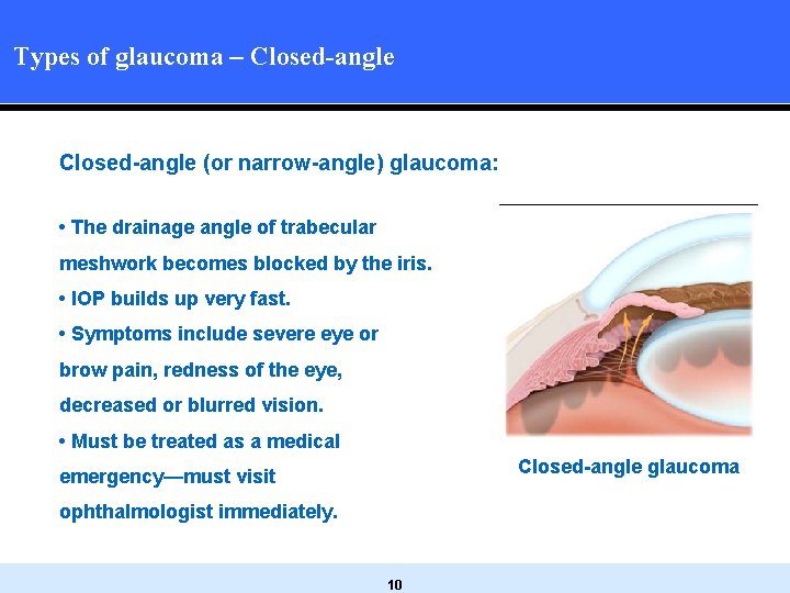 Types of glaucoma – Closed-angle (or narrow-angle) glaucoma: • The drainage angle of trabecular Types of glaucoma – Closed-angle (or narrow-angle) glaucoma: • The drainage angle of trabecular