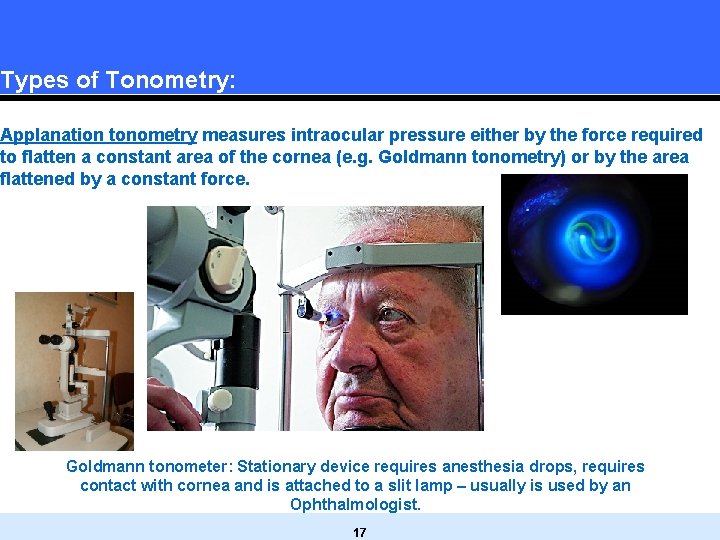 Types of Tonometry: Applanation tonometry measures intraocular pressure either by the force required to Types of Tonometry: Applanation tonometry measures intraocular pressure either by the force required to