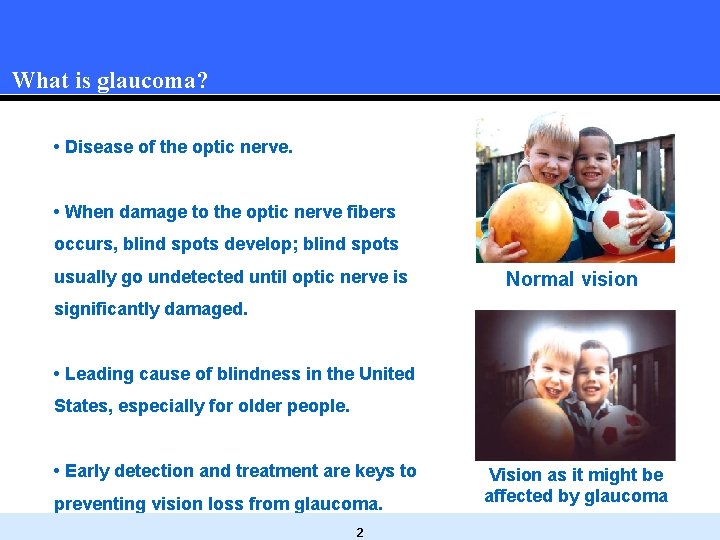 What is glaucoma? • Disease of the optic nerve. • When damage to the What is glaucoma? • Disease of the optic nerve. • When damage to the