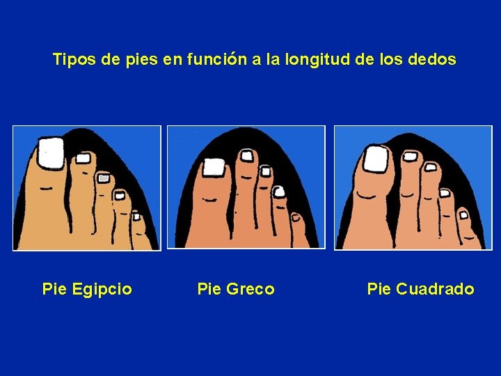 Tipos de pies en función a la longitud de los dedos Pie Egipcio Pie