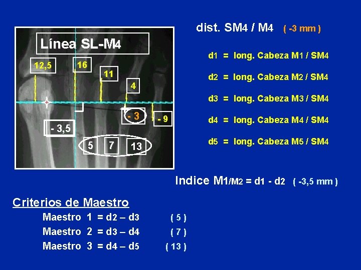 dist. SM 4 / M 4 Línea SL-M 4 12, 5 16 ( -3