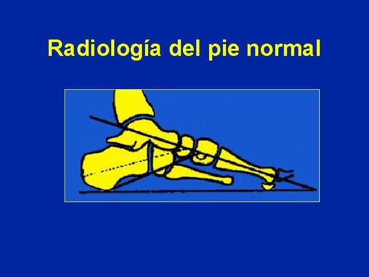 Radiología del pie normal 