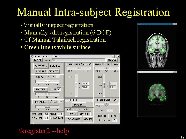 Manual Intra-subject Registration • Visually inspect registration • Manually edit registration (6 DOF) •