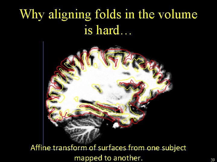 Why aligning folds in the volume is hard… Affine transform of surfaces from one