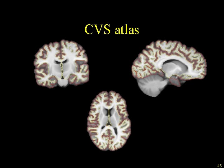 CVS atlas 48 