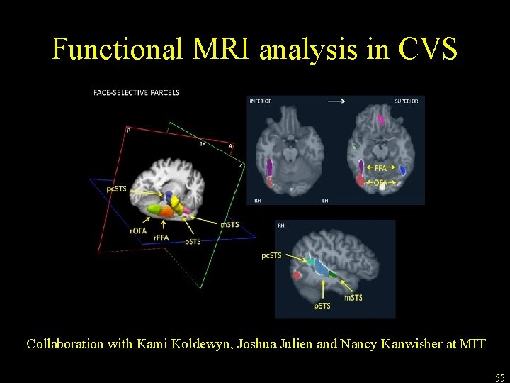 Functional MRI analysis in CVS space Collaboration with Kami Koldewyn, Joshua Julien and Nancy