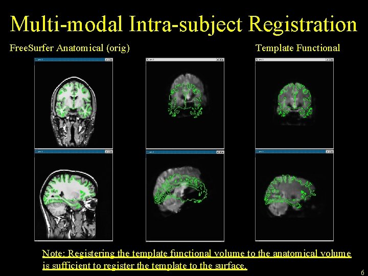 Multi-modal Intra-subject Registration Free. Surfer Anatomical (orig) Template Functional Note: Registering the template functional