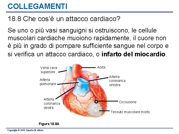 COLLEGAMENTI 18. 8 Che cos’è un attacco cardiaco? Se uno o più vasi sanguigni
