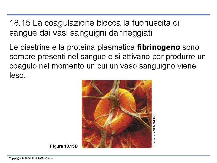18. 15 La coagulazione blocca la fuoriuscita di sangue dai vasi sanguigni danneggiati Figura