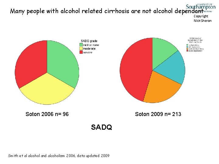 Many people with alcohol related cirrhosis are not alcohol dependant Copyright Nick Sheron Soton