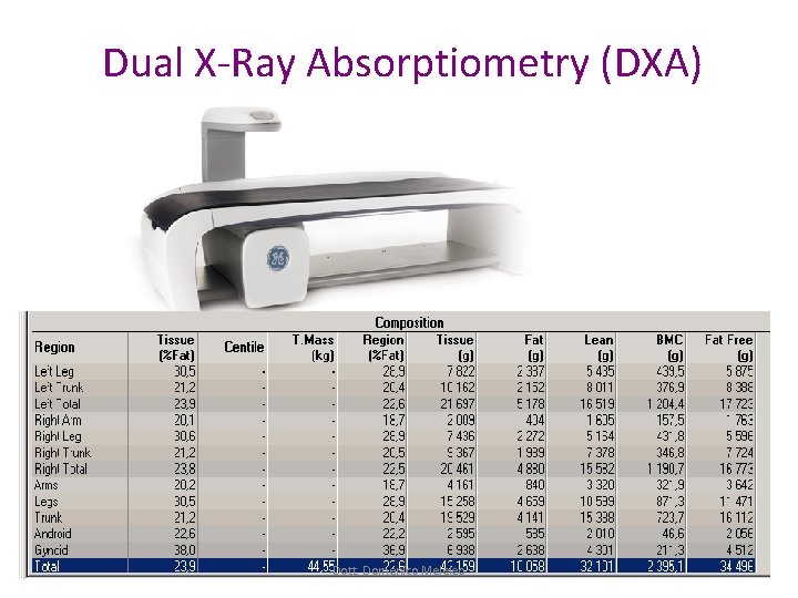 Dual X-Ray Absorptiometry (DXA) Dott. Domenico Meleleo Dual X-Ray Absorptiometry (DXA) Dott. Domenico Meleleo