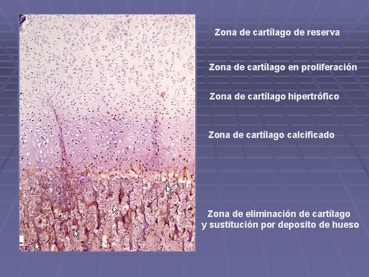 Zona de cartílago de reserva Zona de cartílago en proliferación Zona de cartílago hipertrófico