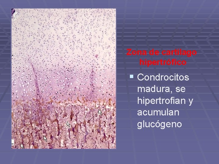 Zona de cartílago hipertrófico § Condrocitos madura, se hipertrofian y acumulan glucógeno 