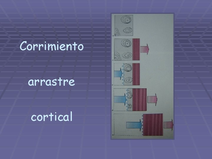 Corrimiento arrastre cortical 