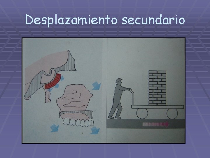 Desplazamiento secundario 