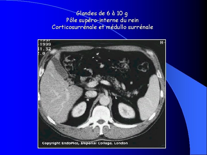 Glandes de 6 à 10 g Pôle supéro-interne du rein Corticosurrénale et médullo surrénale