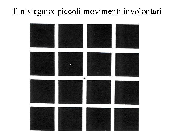 Il nistagmo: piccoli movimenti involontari 