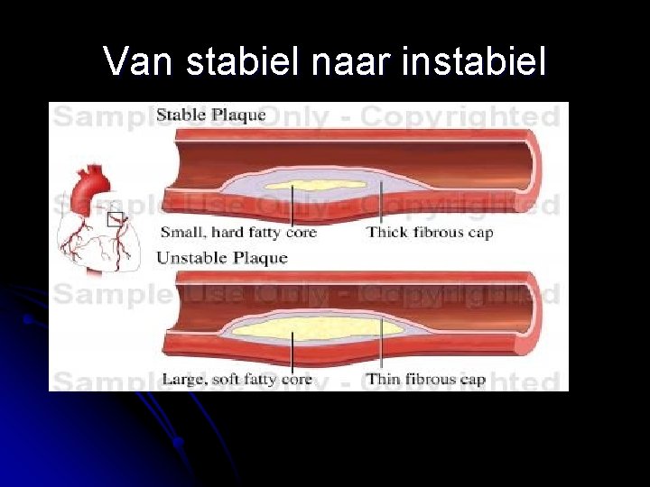 Van stabiel naar instabiel 