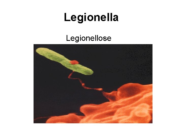 Legionella Legionellose 