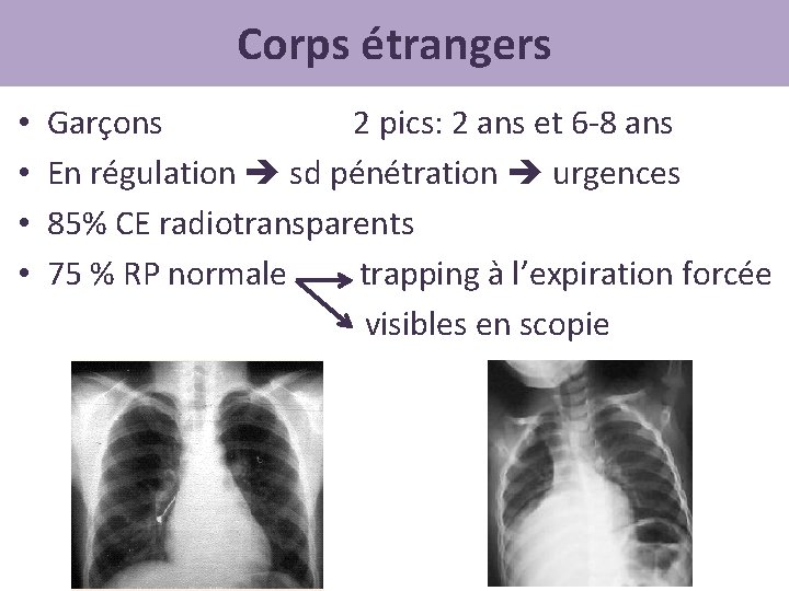 Corps étrangers • • Garçons 2 pics: 2 ans et 6 -8 ans En