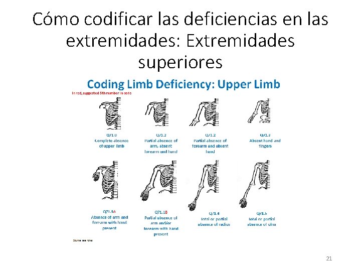 Cómo codificar las deficiencias en las extremidades: Extremidades superiores 21 