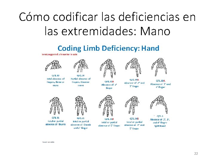 Cómo codificar las deficiencias en las extremidades: Mano 22 