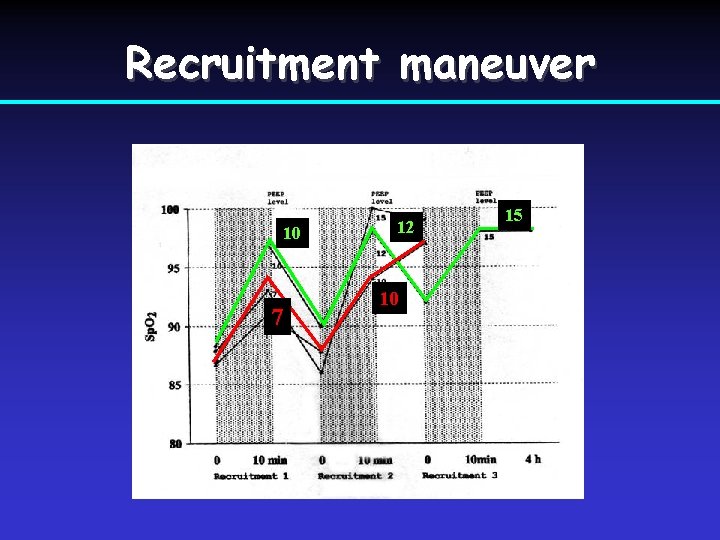 Recruitment maneuver 10 7 12 10 15 