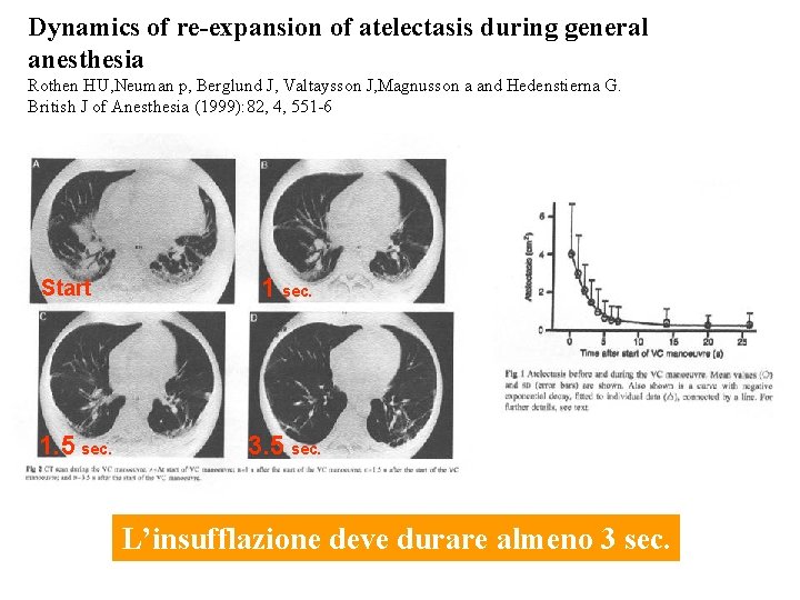 Dynamics of re-expansion of atelectasis during general anesthesia Rothen HU, Neuman p, Berglund J,