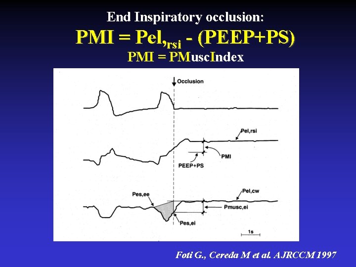 End Inspiratory occlusion: PMI = Pel, rsi - (PEEP+PS) PMI = PMusc. Index Foti