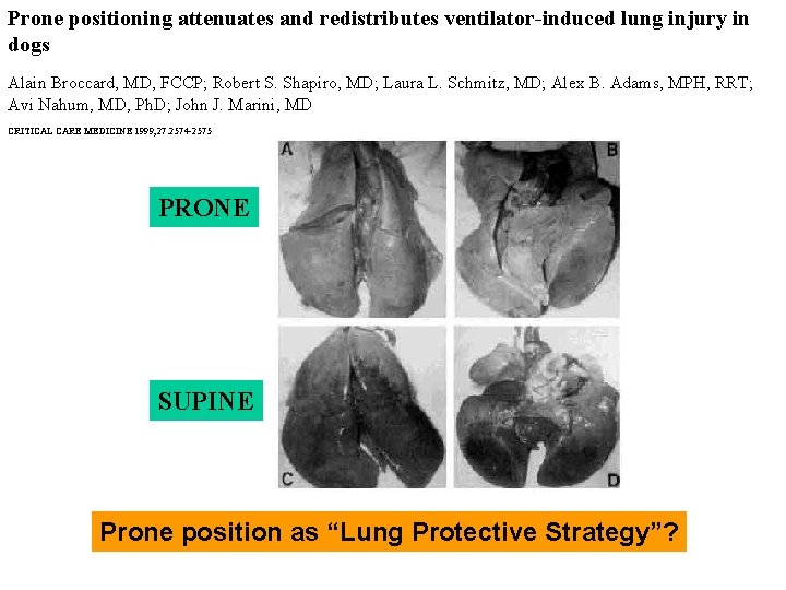 Prone positioning attenuates and redistributes ventilator-induced lung injury in dogs Alain Broccard, MD, FCCP;