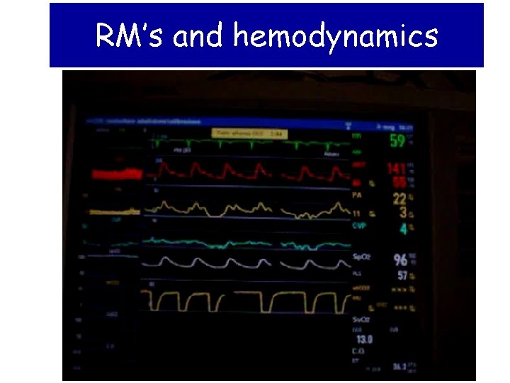 RM’s and hemodynamics 