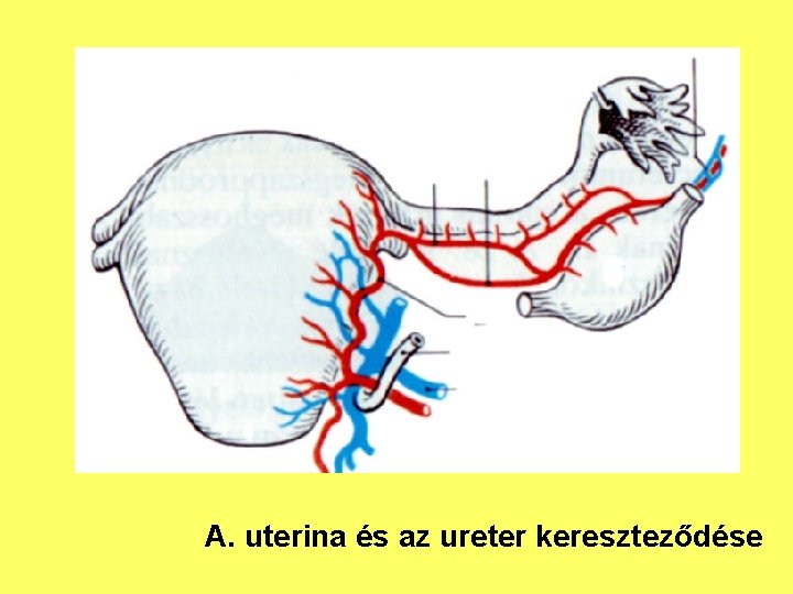 A. uterina és az ureter kereszteződése 