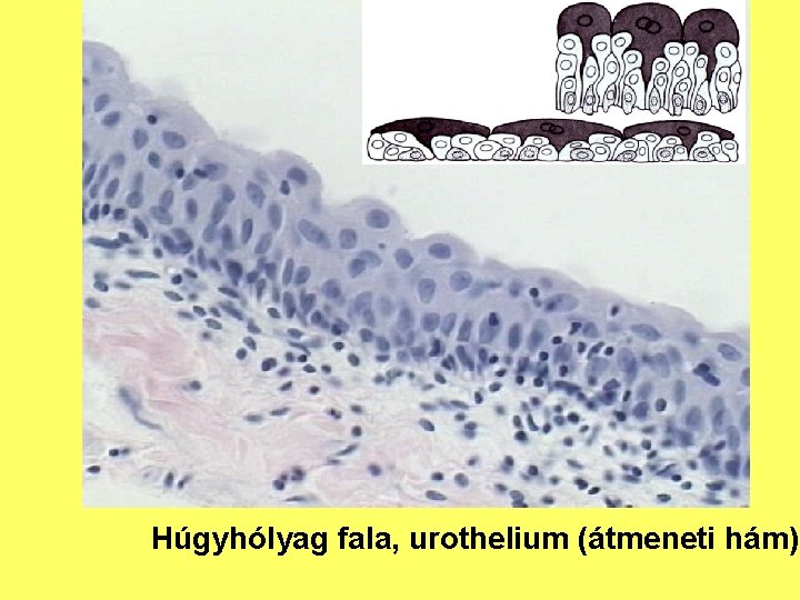 Húgyhólyag fala, urothelium (átmeneti hám) 