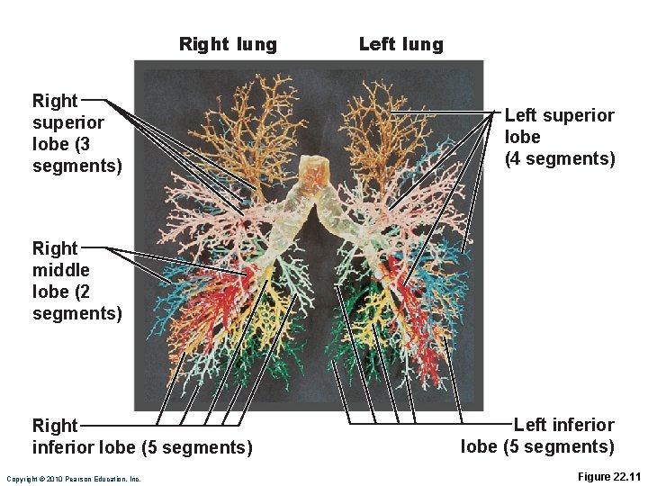 Right lung Right superior lobe (3 segments) Left lung Left superior lobe (4 segments)