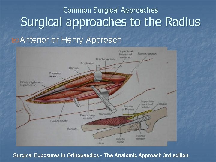 Common Surgical Approaches Surgical approaches to the Radius Anterior or Henry Approach Surgical Exposures