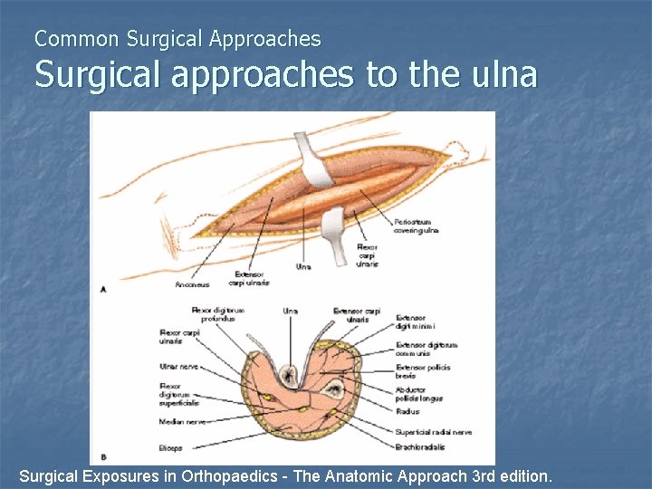 Common Surgical Approaches Surgical approaches to the ulna Surgical Exposures in Orthopaedics - The