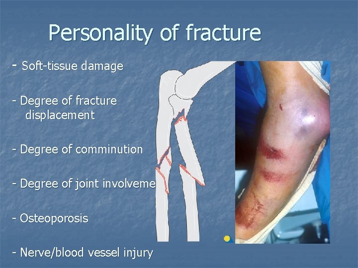 Personality of fracture - Soft-tissue damage - Degree of fracture displacement - Degree of