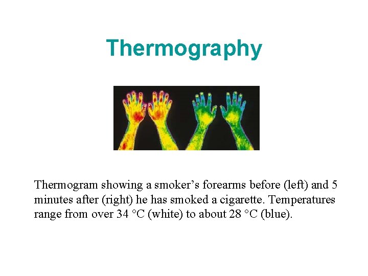 Thermography Thermogram showing a smoker’s forearms before (left) and 5 minutes after (right) he Thermography Thermogram showing a smoker’s forearms before (left) and 5 minutes after (right) he