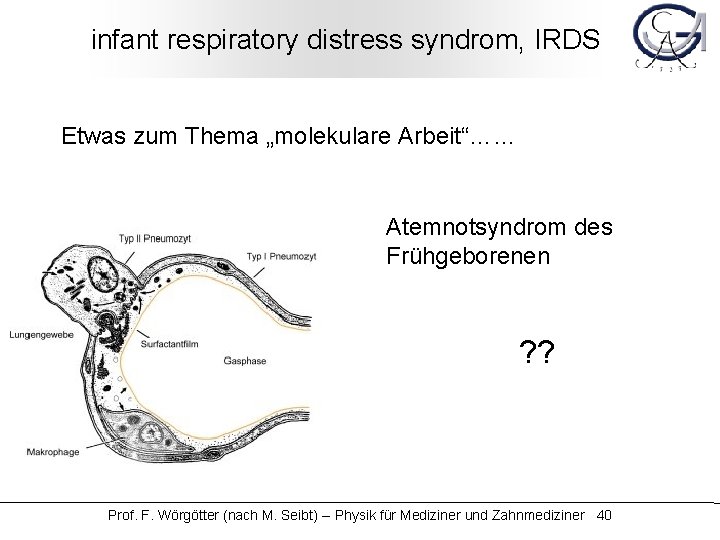 infant respiratory distress syndrom, IRDS Etwas zum Thema „molekulare Arbeit“…… Atemnotsyndrom des Frühgeborenen ?