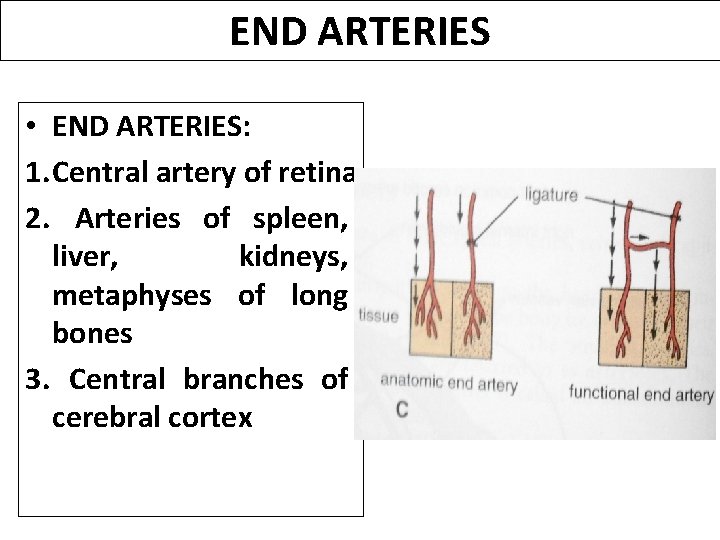 END ARTERIES • END ARTERIES: 1. Central artery of retina 2. Arteries of spleen,