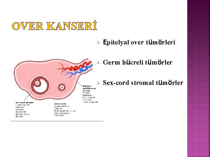 OVER KANSERİ Ø Epitelyal over tümörleri Ø Germ hücreli tümörler Ø Sex-cord stromal tümörler