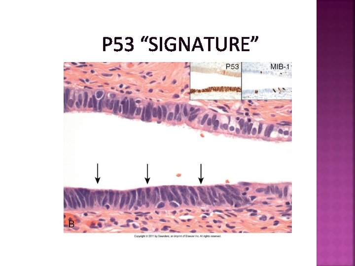 P 53 “SIGNATURE” 