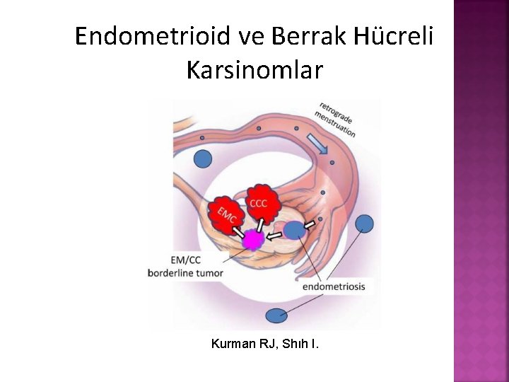 Endometrioid ve Berrak Hücreli Karsinomlar Kurman RJ, Shıh I. 