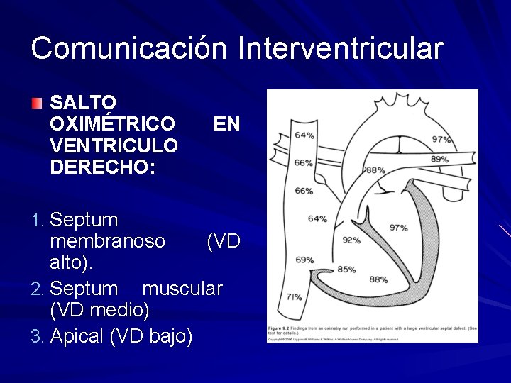 Comunicación Interventricular SALTO OXIMÉTRICO VENTRICULO DERECHO: 1. Septum EN membranoso (VD alto). 2. Septum