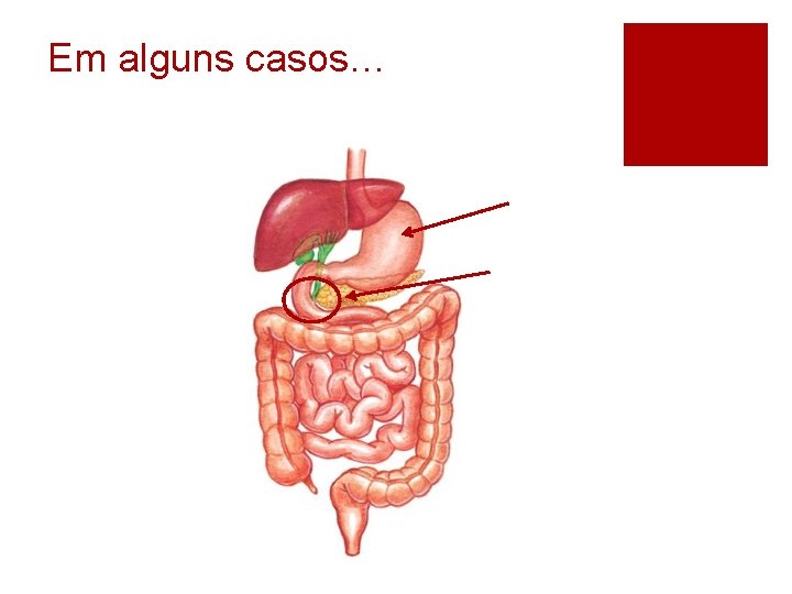 Em alguns casos… 