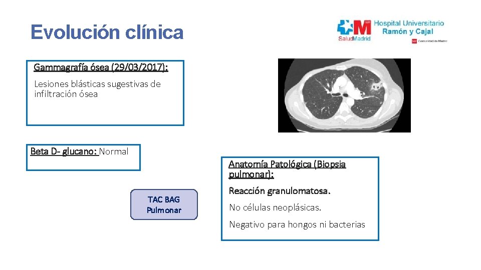 Evolución clínica Gammagrafía ósea (29/03/2017): Lesiones blásticas sugestivas de infiltración ósea Beta D- glucano: