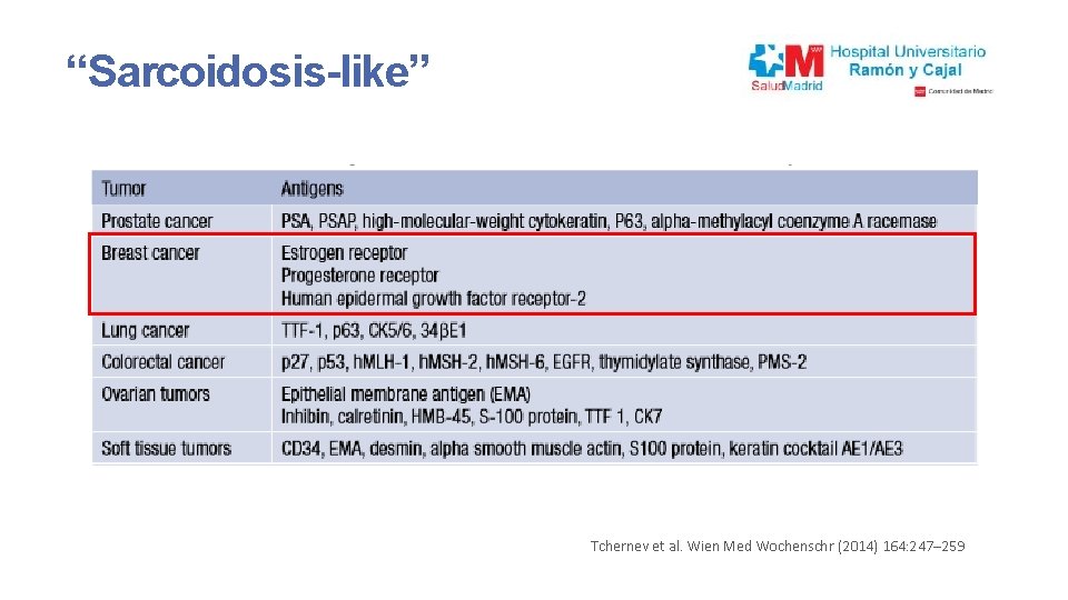 “Sarcoidosis-like” Tchernev et al. Wien Med Wochenschr (2014) 164: 247– 259 